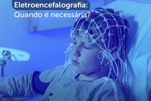 Eletroencefalografia: quando é necessária?