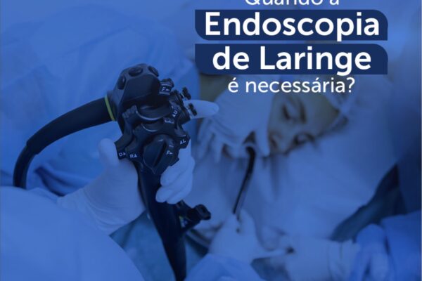 Quando a endoscopia de laringe é necessária?