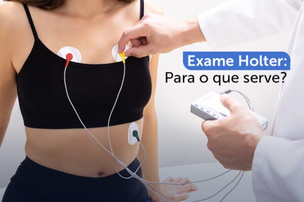 Exame de Holter: para que serve